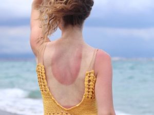 What Your Skin May Be Showing After Summer
