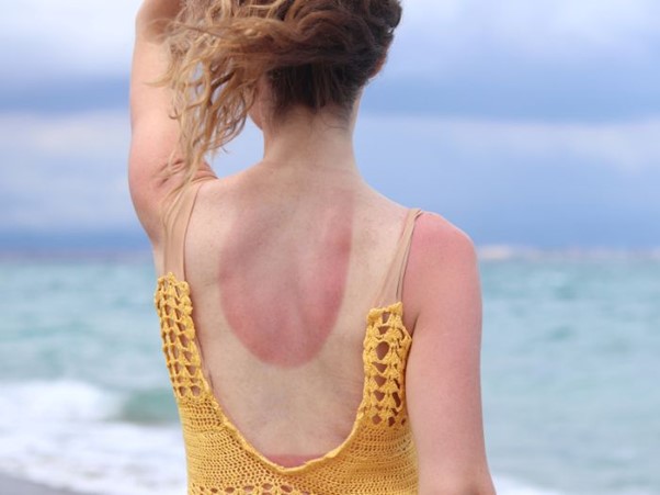 Is sunshine good for you